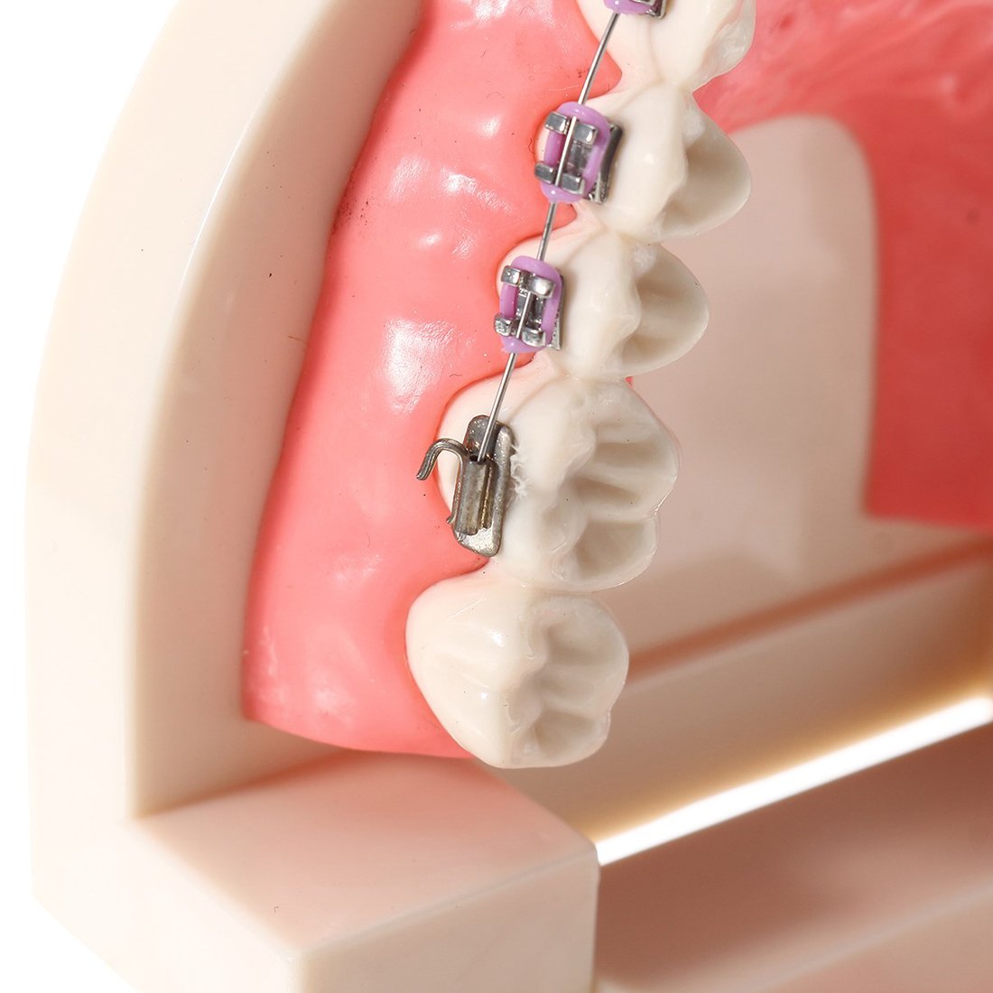 Amazon.co.jp: Oral Dentistry 矯正歯科モデル 歯列模型 説明モデル